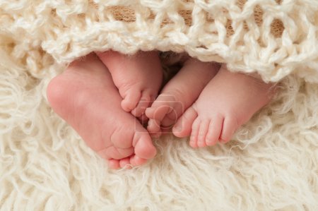 panorama test ciąża bliźniacza jednojajowa lub ciąża dwujajowa